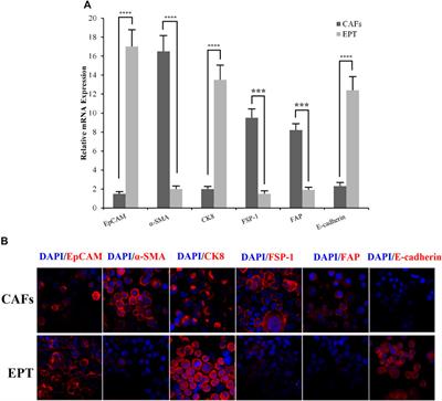 Identification of novel candidate targets for suppressing ovarian cancer progression through IL-33/ST2 axis components using the system biology approach